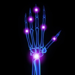 arthritis and heart disease
