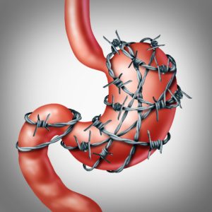 Ulcer drugs and your micrrobiome