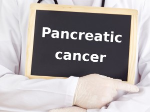 pancreatic cancer prevention